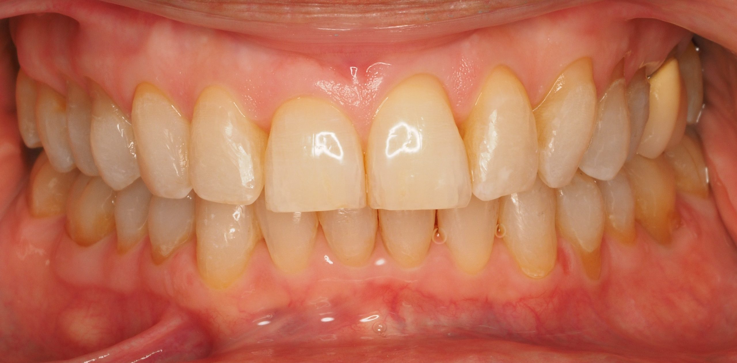 Antes y después - Doctora Susana Rodríguez