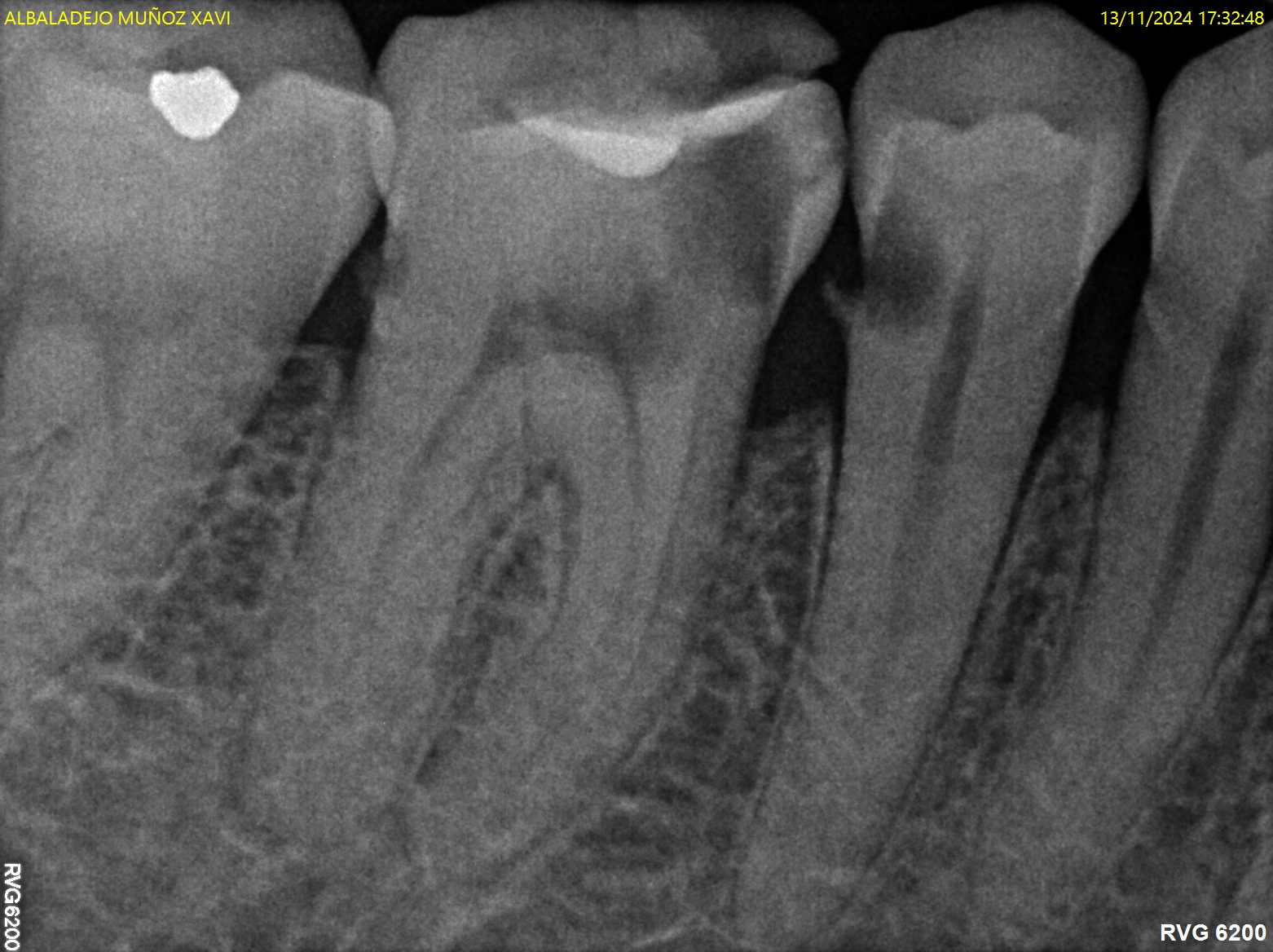 Antes y después - Doctora Susana Rodríguez