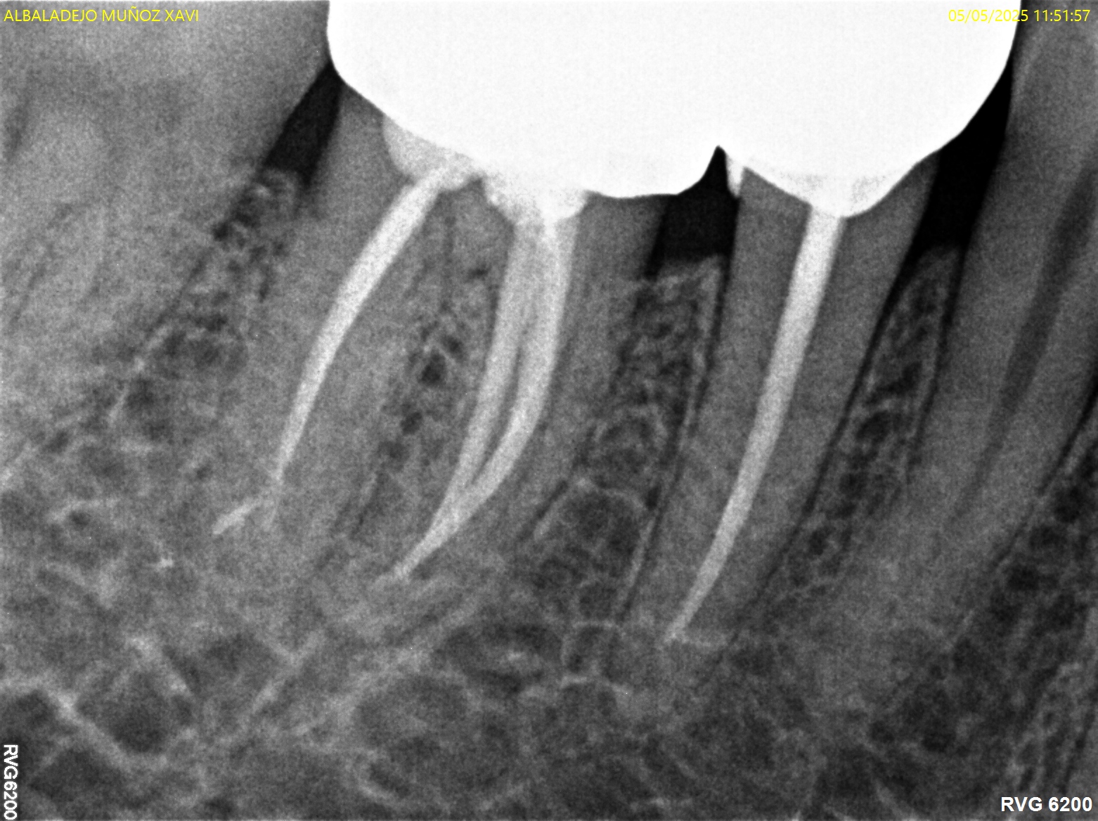 Antes y después - Doctora Susana Rodríguez