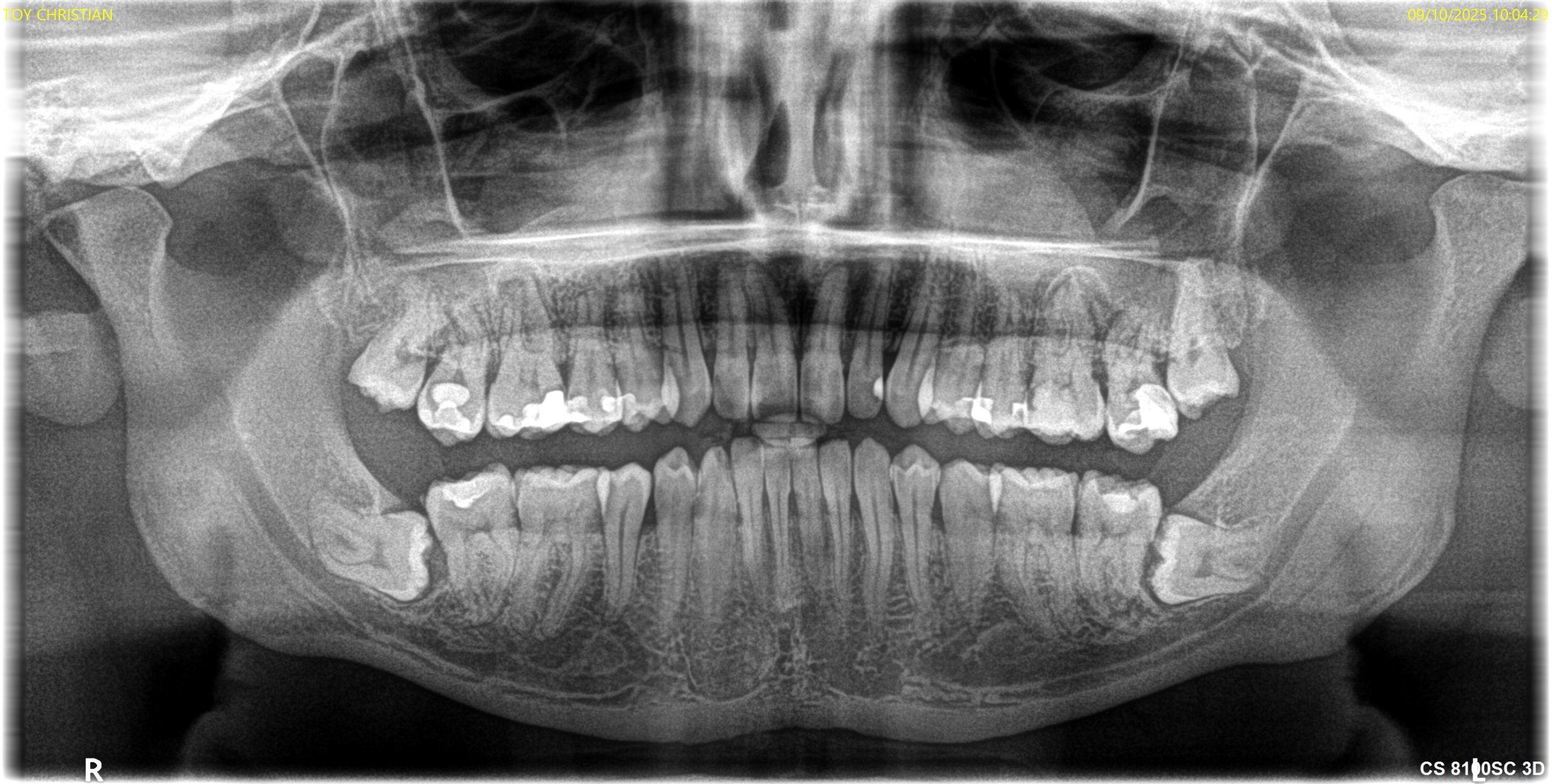 Antes y después - Doctora Susana Rodríguez