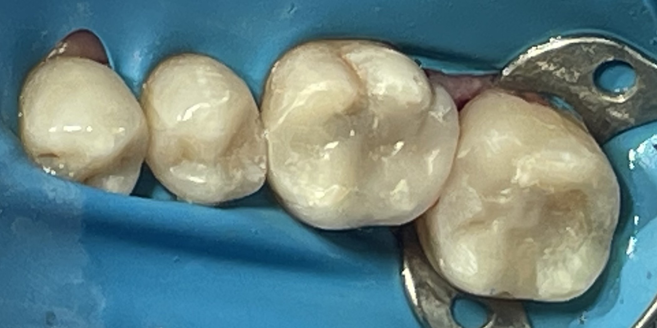 Antes y después - Doctora Susana Rodríguez