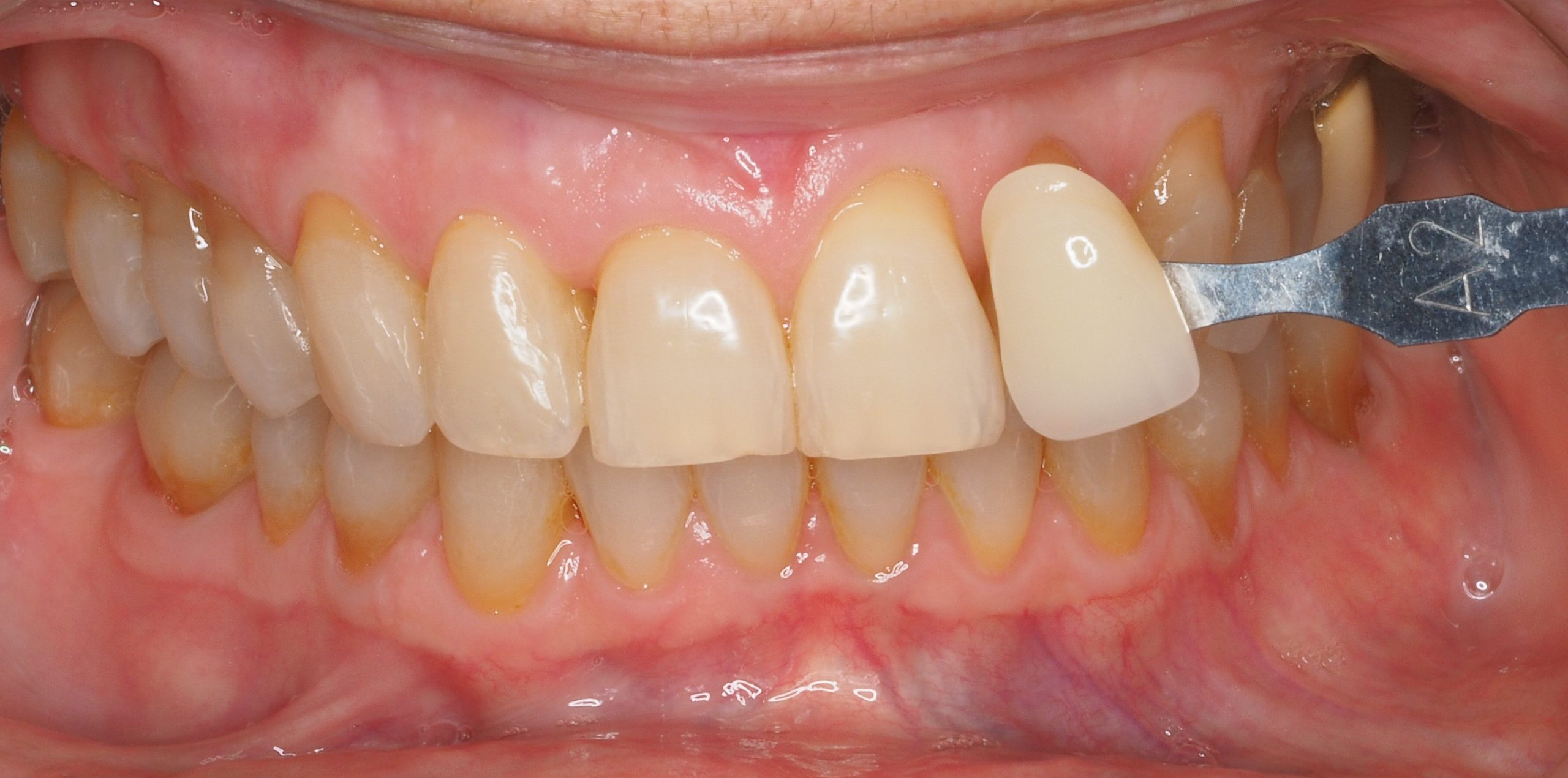 Antes y después - Doctora Susana Rodríguez