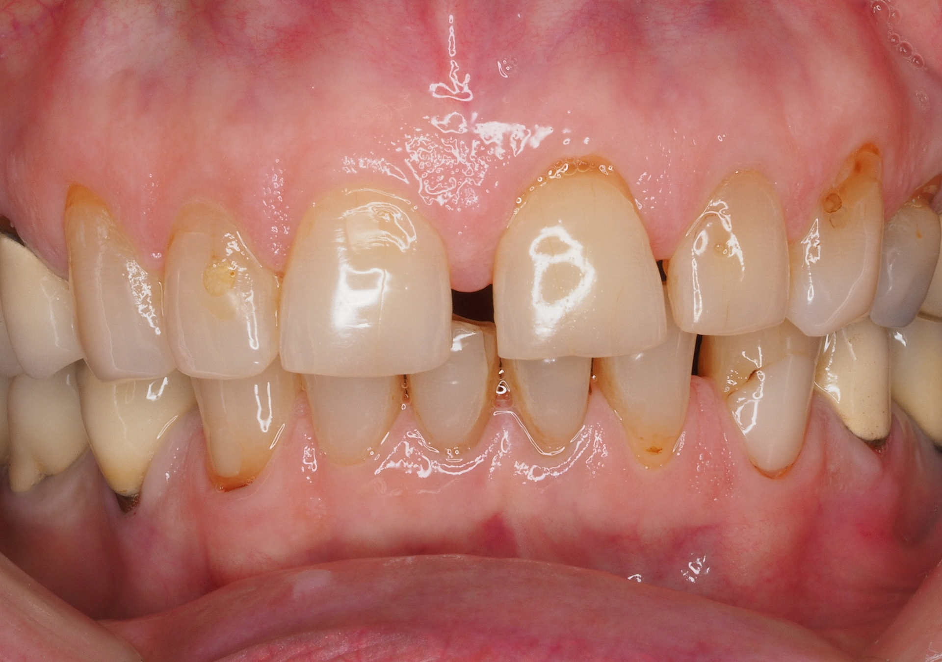 Antes y después - Doctora Susana Rodríguez