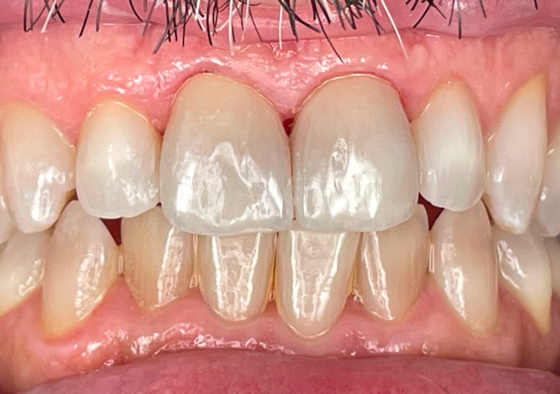 Antes y después - Doctora Susana Rodríguez