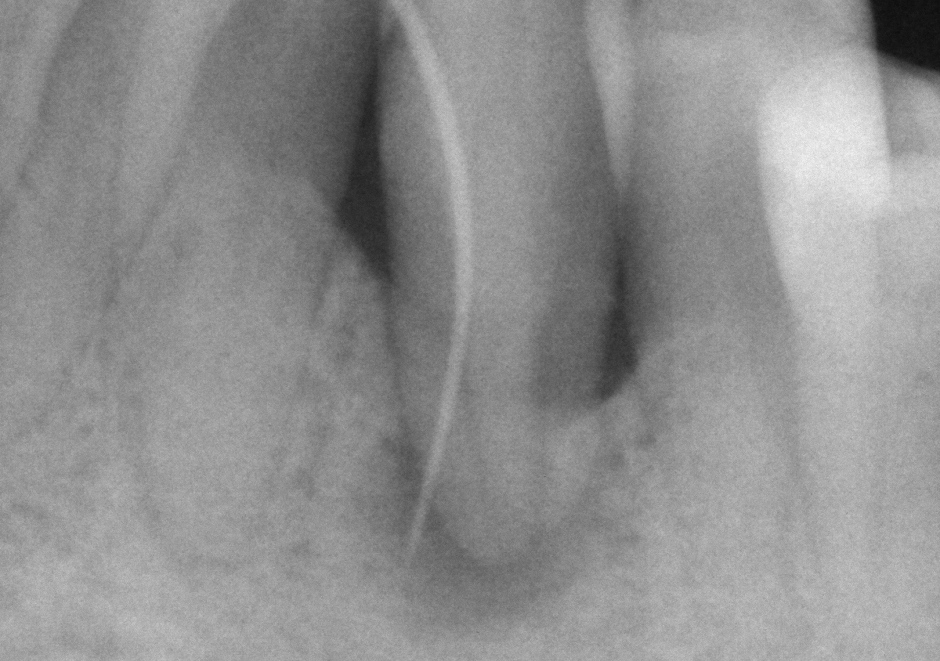Antes y después - Doctora Susana Rodríguez