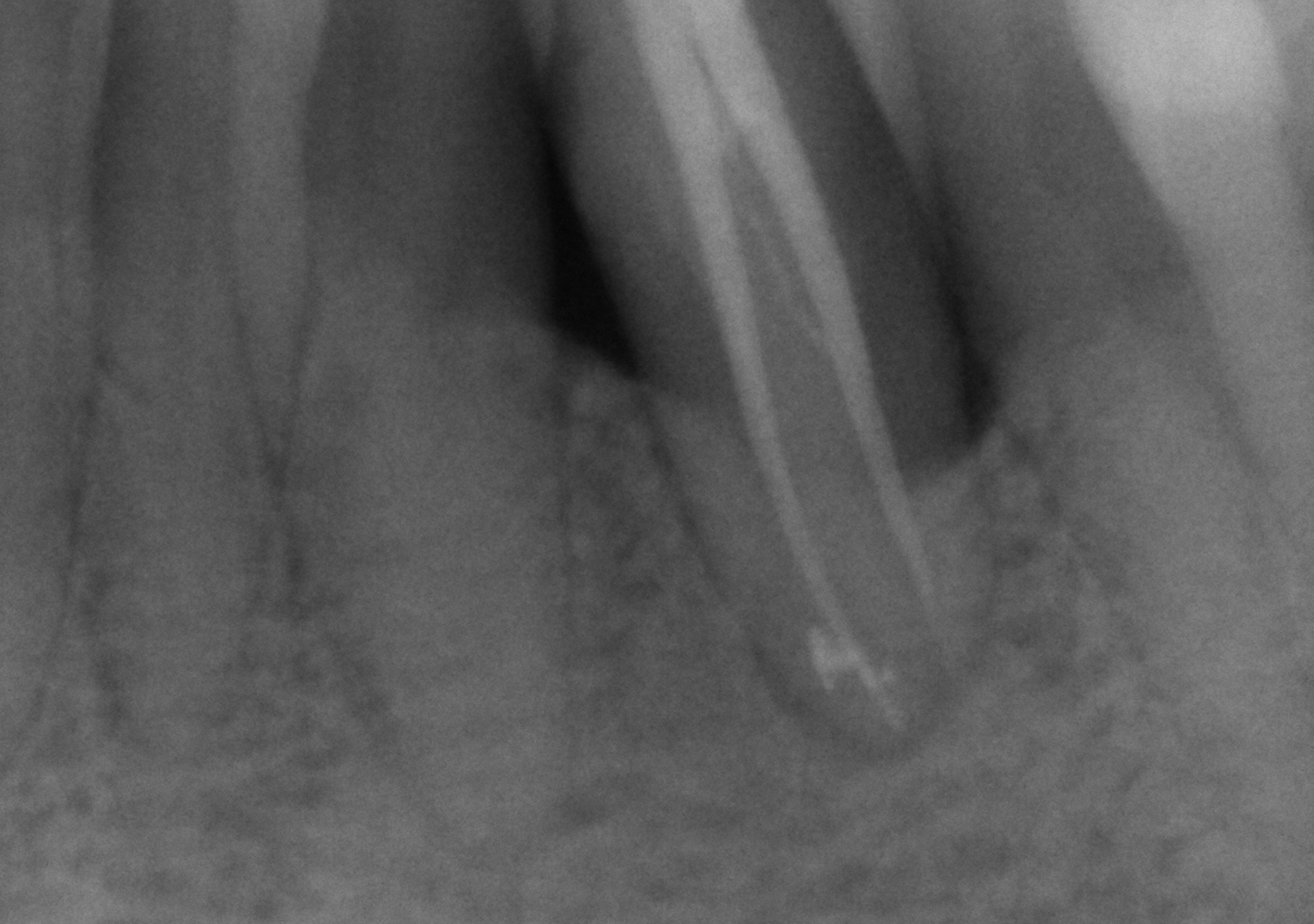 Antes y después - Doctora Susana Rodríguez