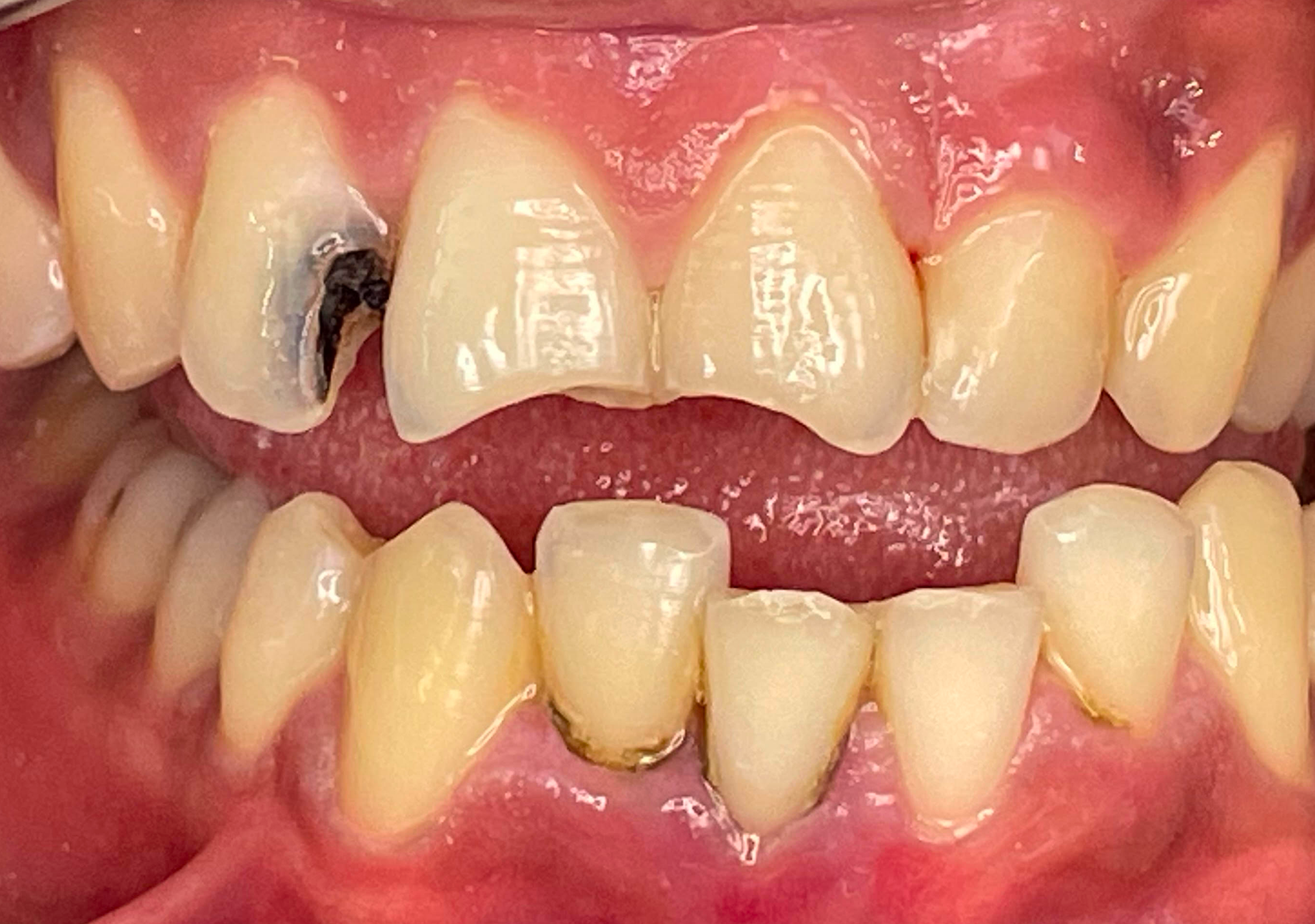 Antes y después - Doctora Susana Rodríguez