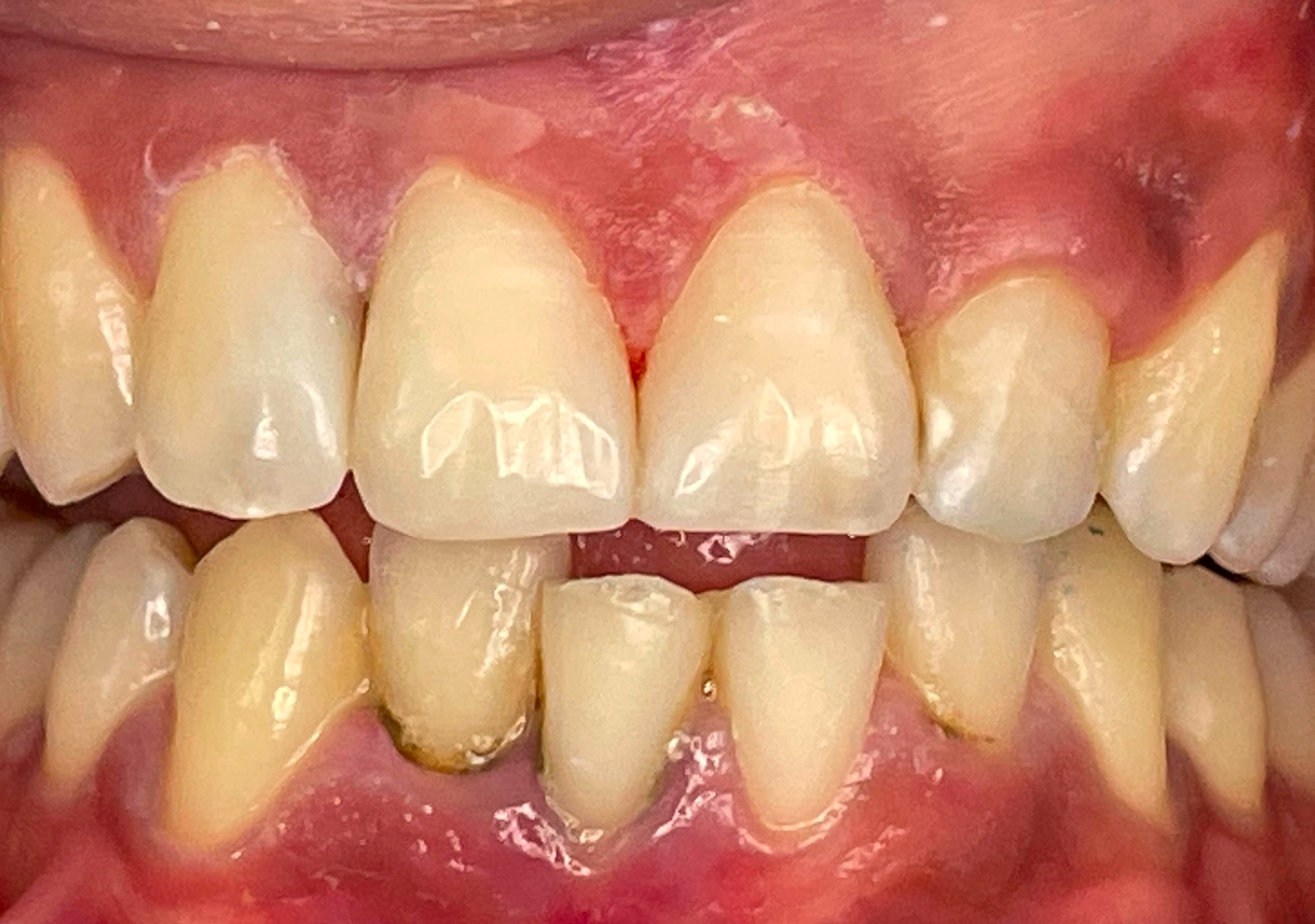 Antes y después - Doctora Susana Rodríguez