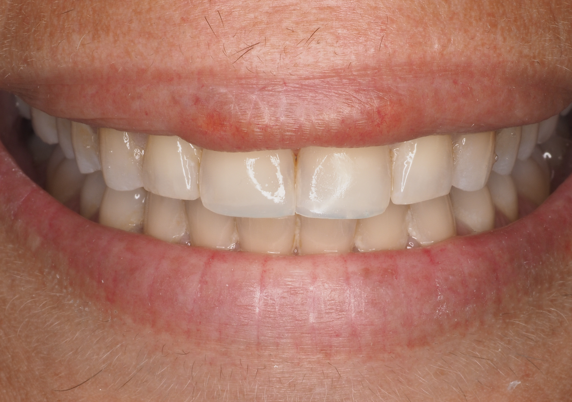 Antes y después - Doctora Susana Rodríguez