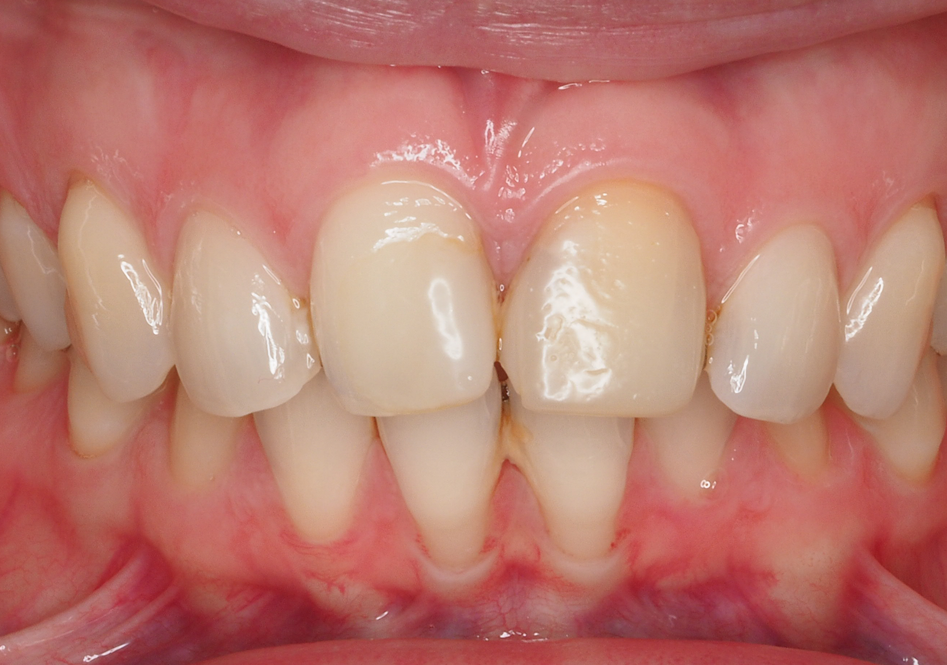 Antes y después - Doctora Susana Rodríguez