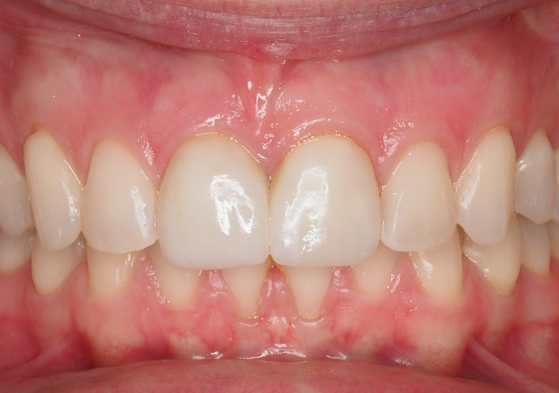 Antes y después - Doctora Susana Rodríguez