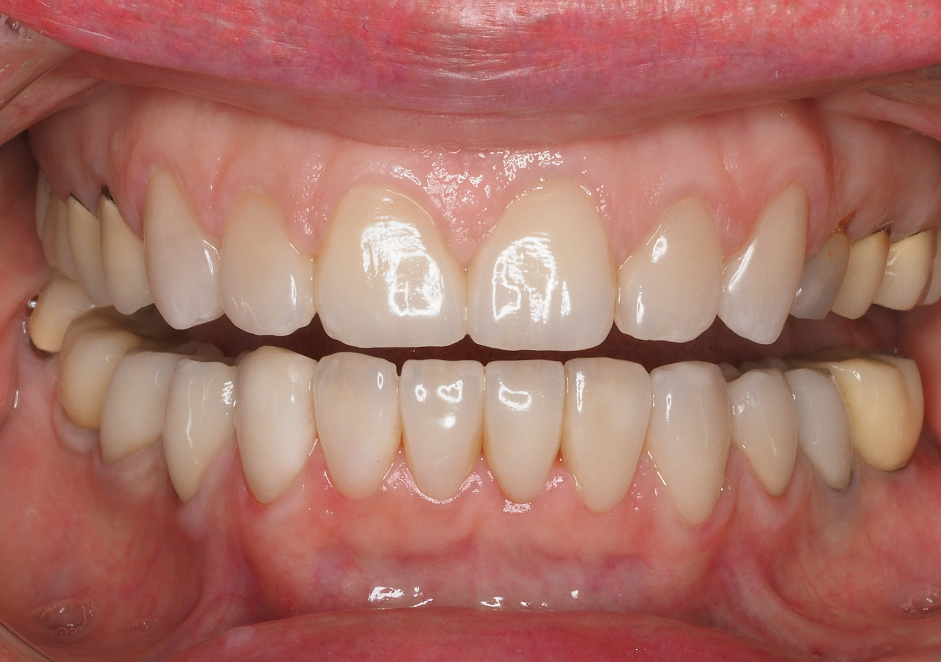 Antes y después - Doctora Susana Rodríguez