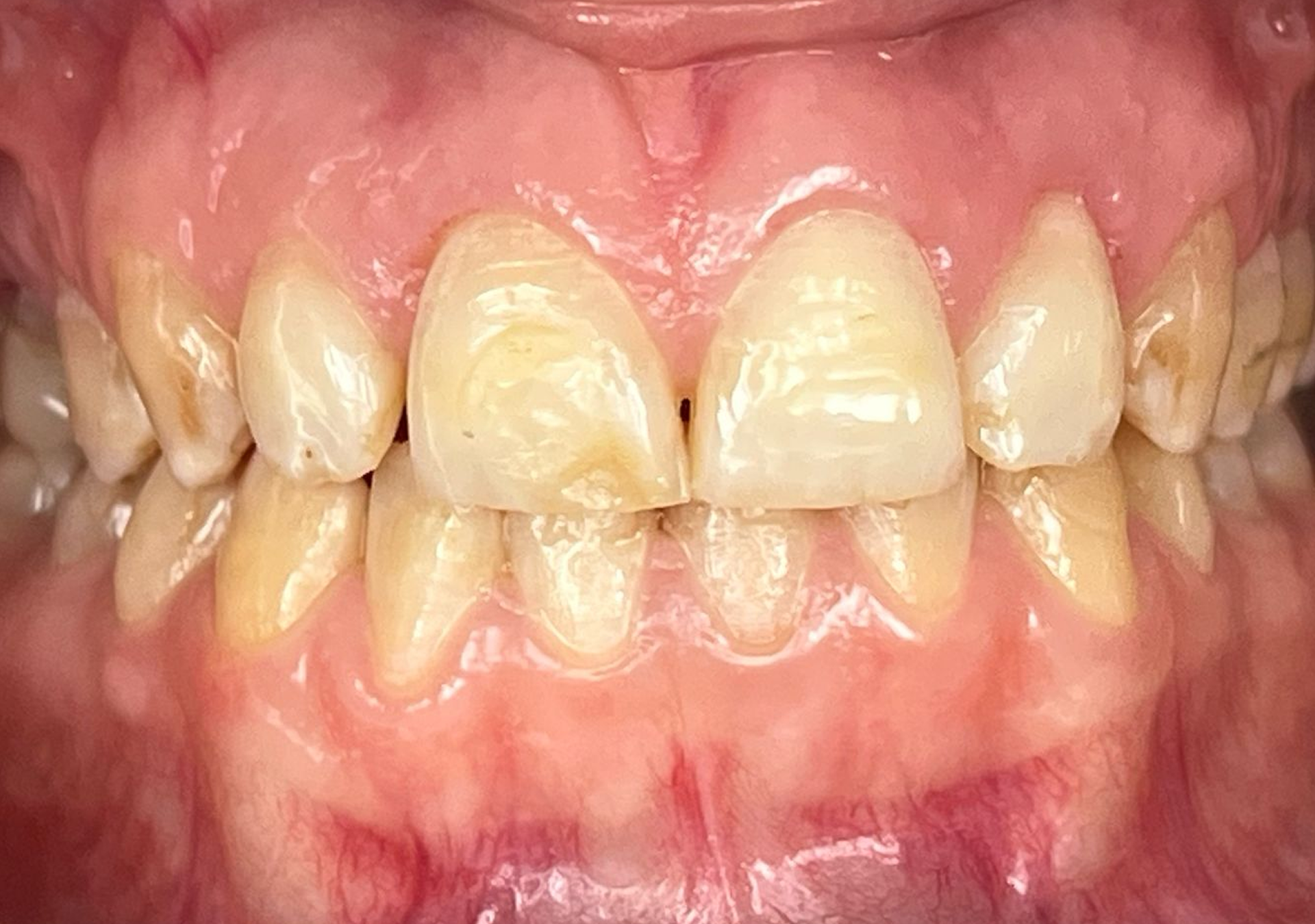 Antes y después - Doctora Susana Rodríguez