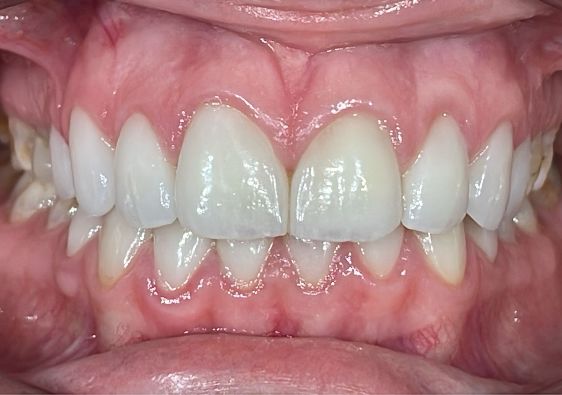 Antes y después - Doctora Susana Rodríguez