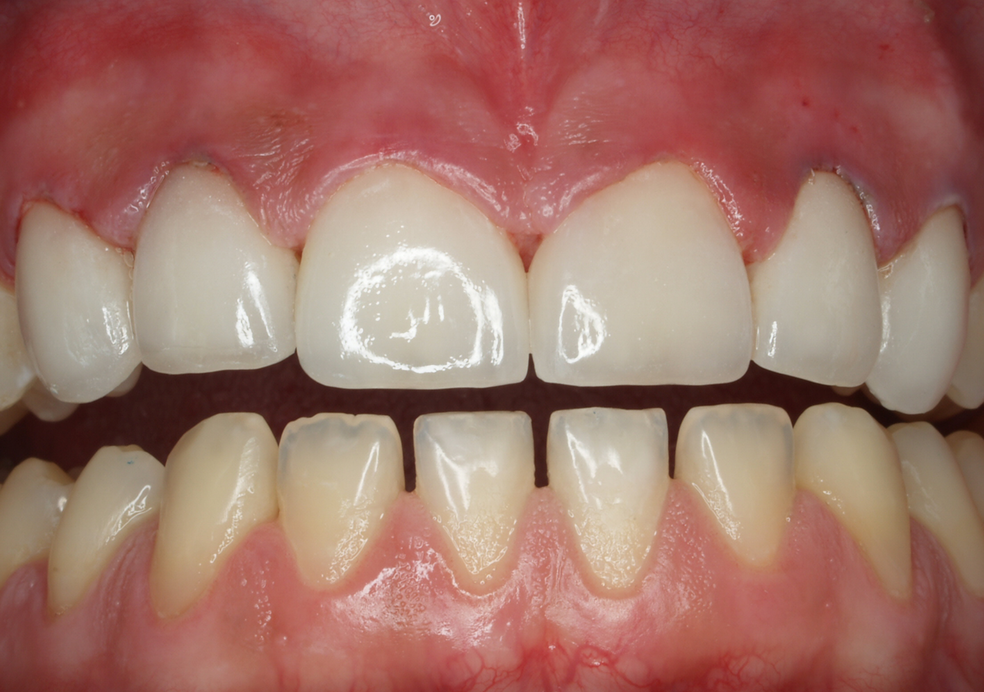 Antes y después - Doctora Susana Rodríguez