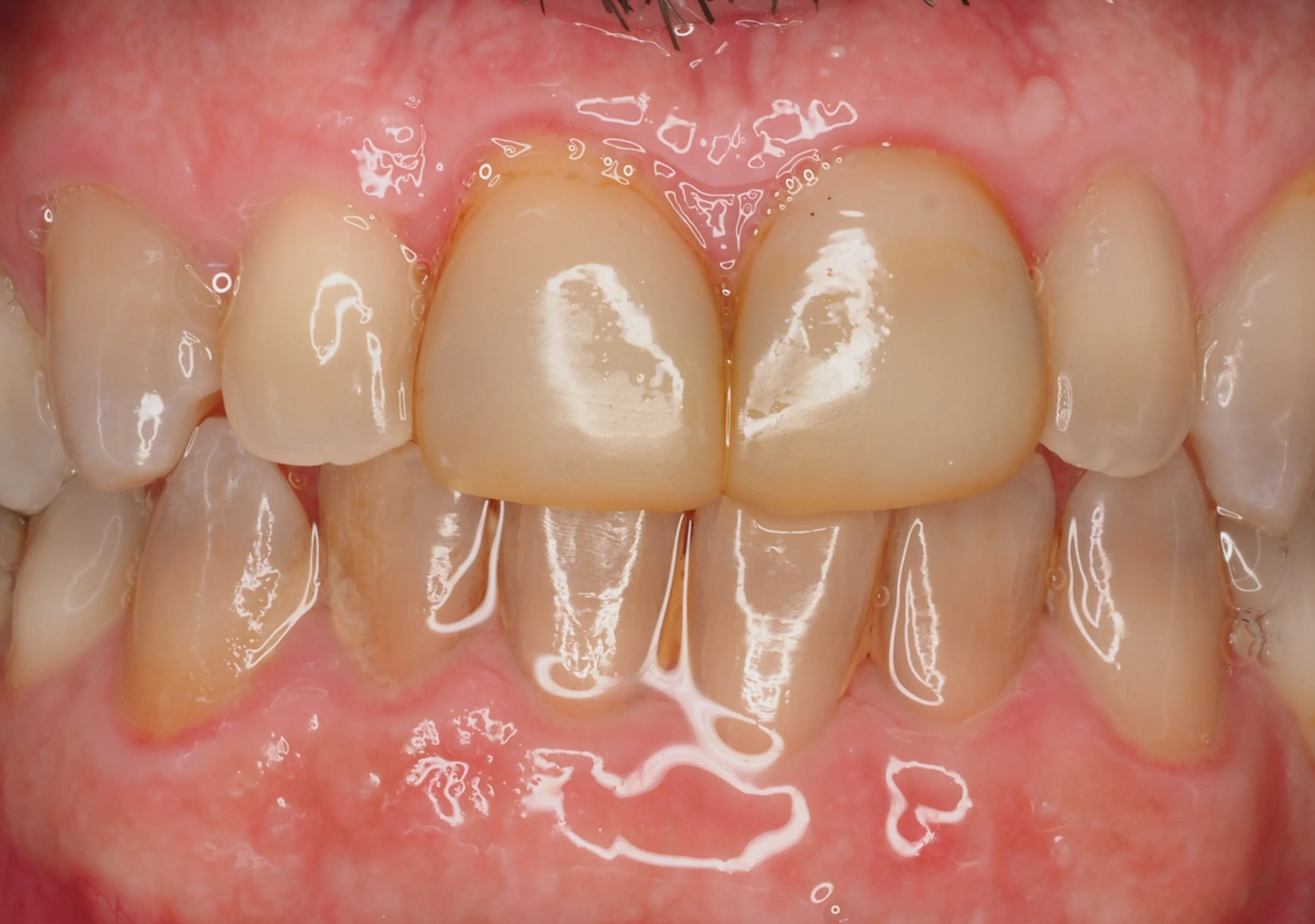 Antes y después - Doctora Susana Rodríguez