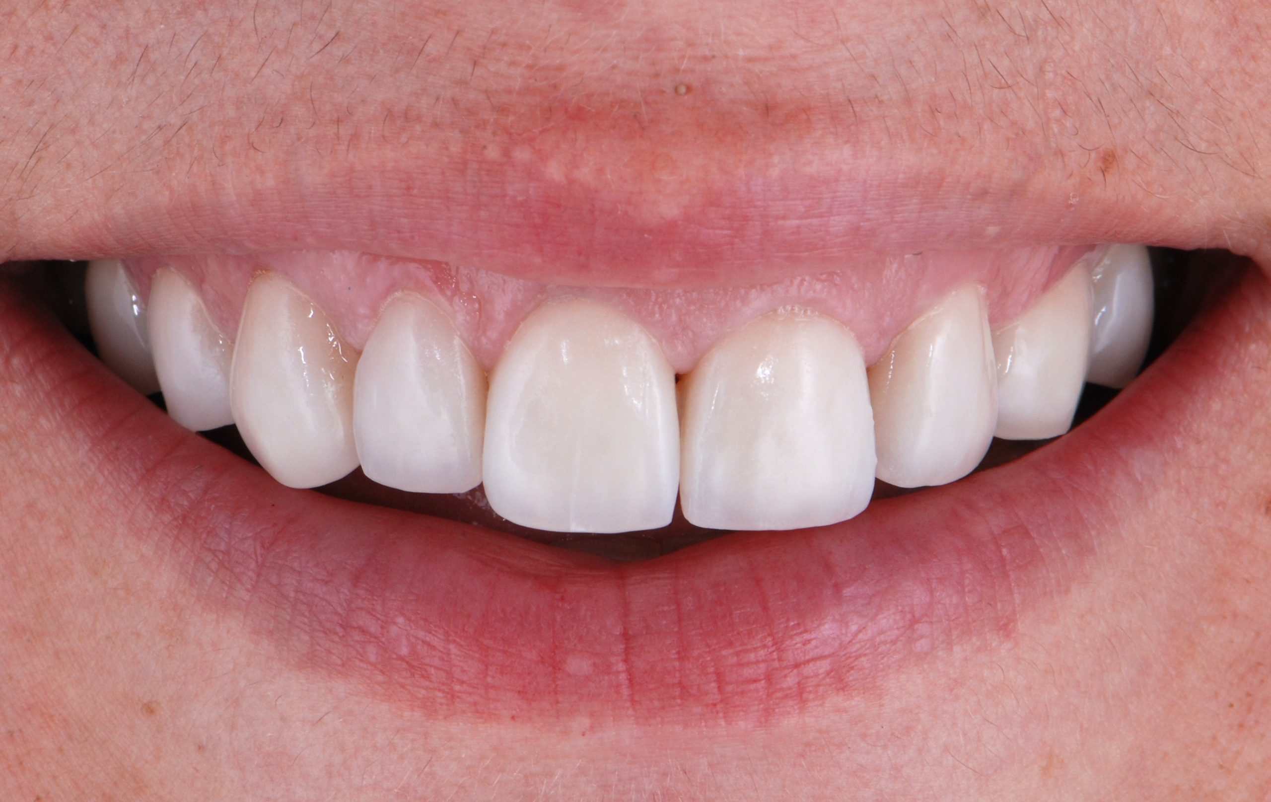 Antes y después - Doctora Susana Rodríguez